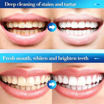 Evolvion GumRevive Periodontal Repair Gel (Pack Of 2pcs)
