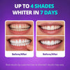 Sakyproral Purple Teeth Whitening Strips Pack Of 30pcs