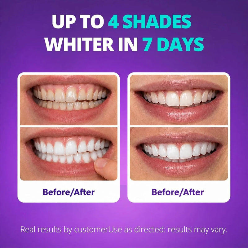 Sakyproral Purple Teeth Whitening Strips Pack Of 30pcs
